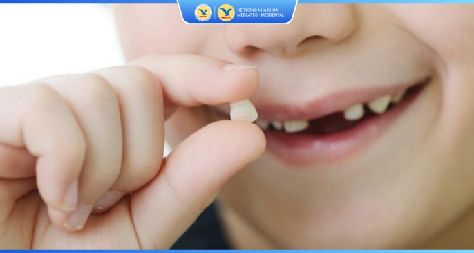 Bảng giá dịch vụ nhổ răng 